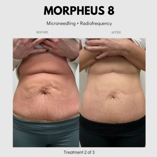 b12 injections st charles Lipotropic | Healthy Size | Medical Weight Loss Clinic Weight Loss Injectables in St.